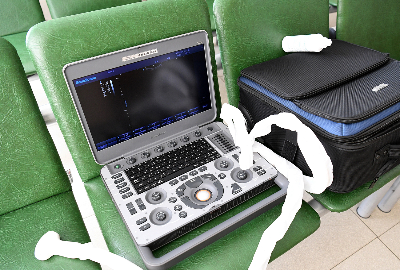 Тверская станция СМП получила современное оборудование