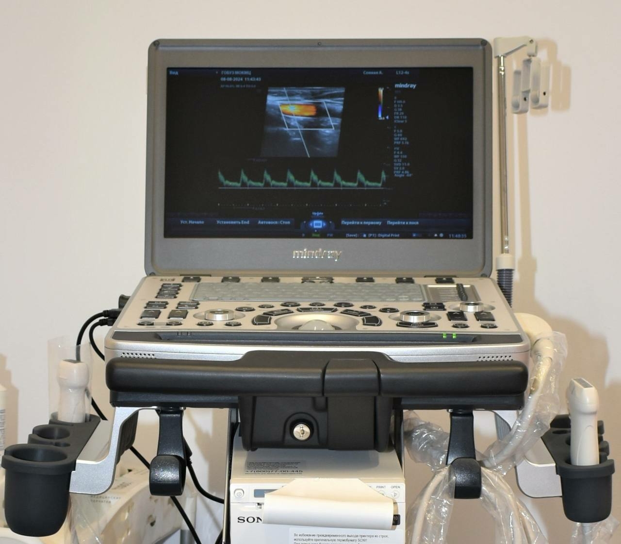 Мурманские медики получили два ультразвуковых сканера
