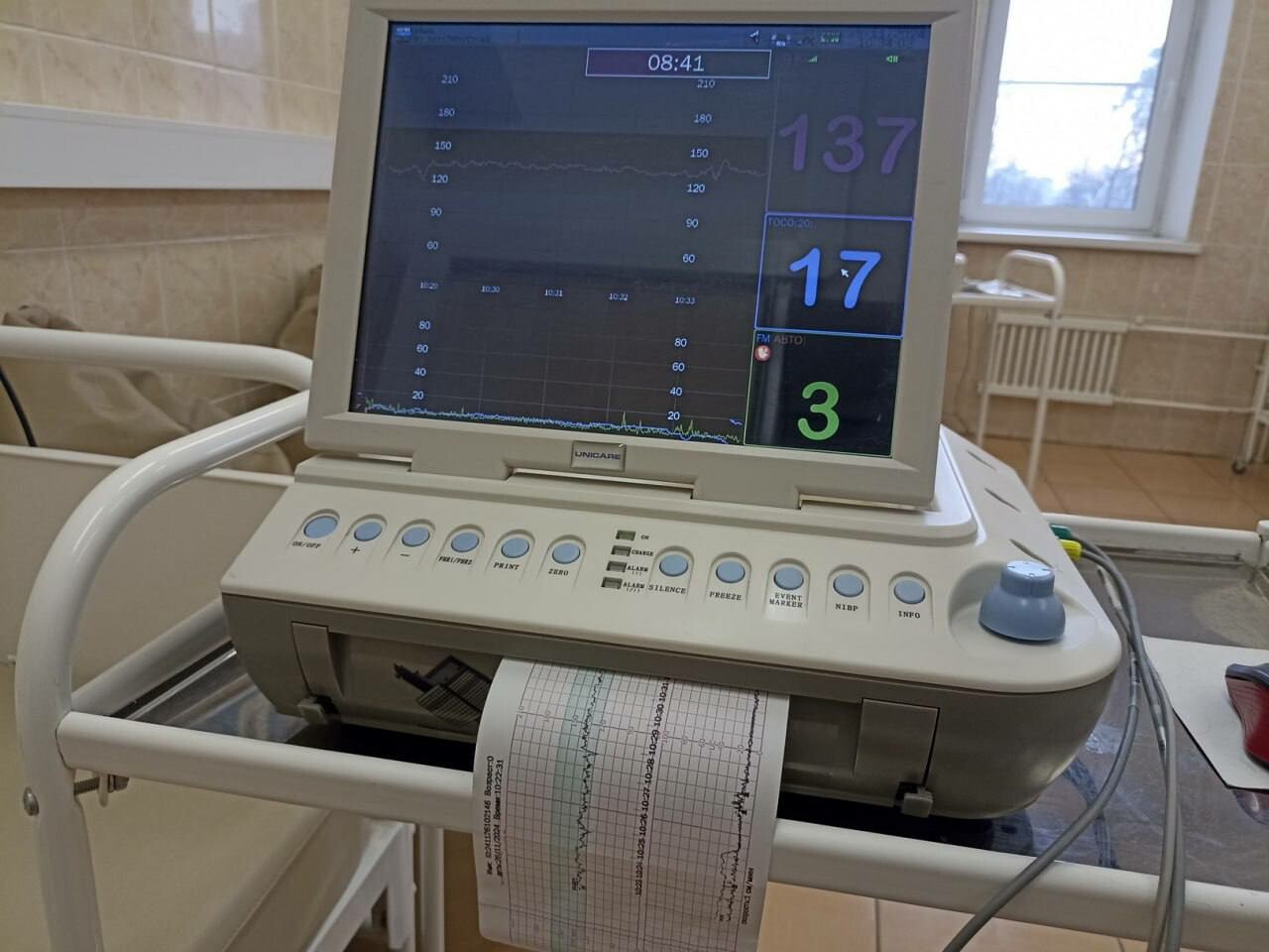 Новые кардиотокографы поступили в перинатальный центр ГО Пушкинский
