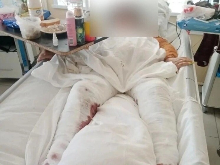 Астраханка добивается через суд компенсации после падения в кипяток