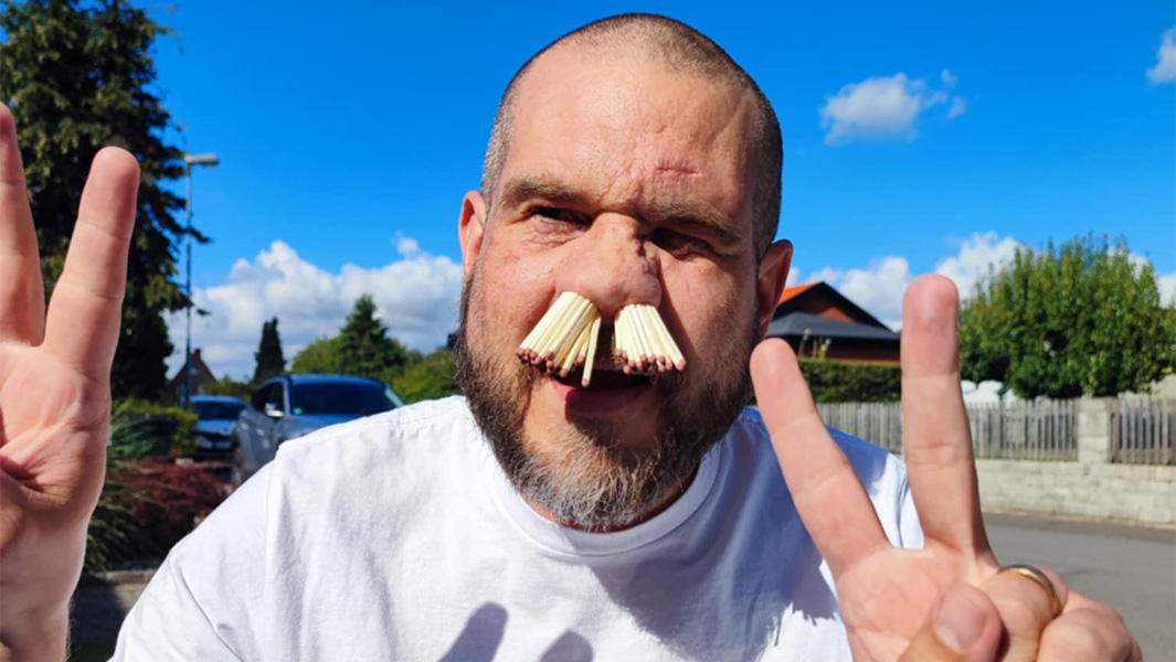 Швед установил мировой рекорд, засунув 81 спичку в нос